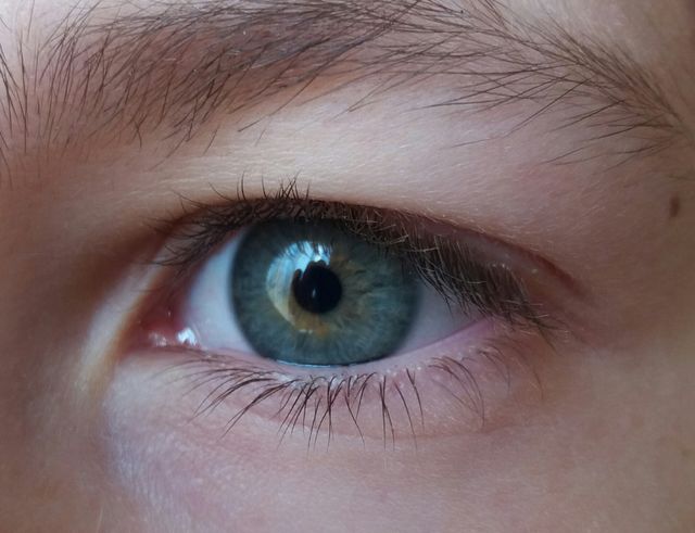 eye