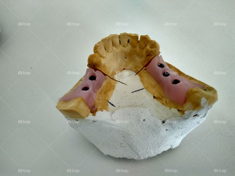 Dental model for implantation