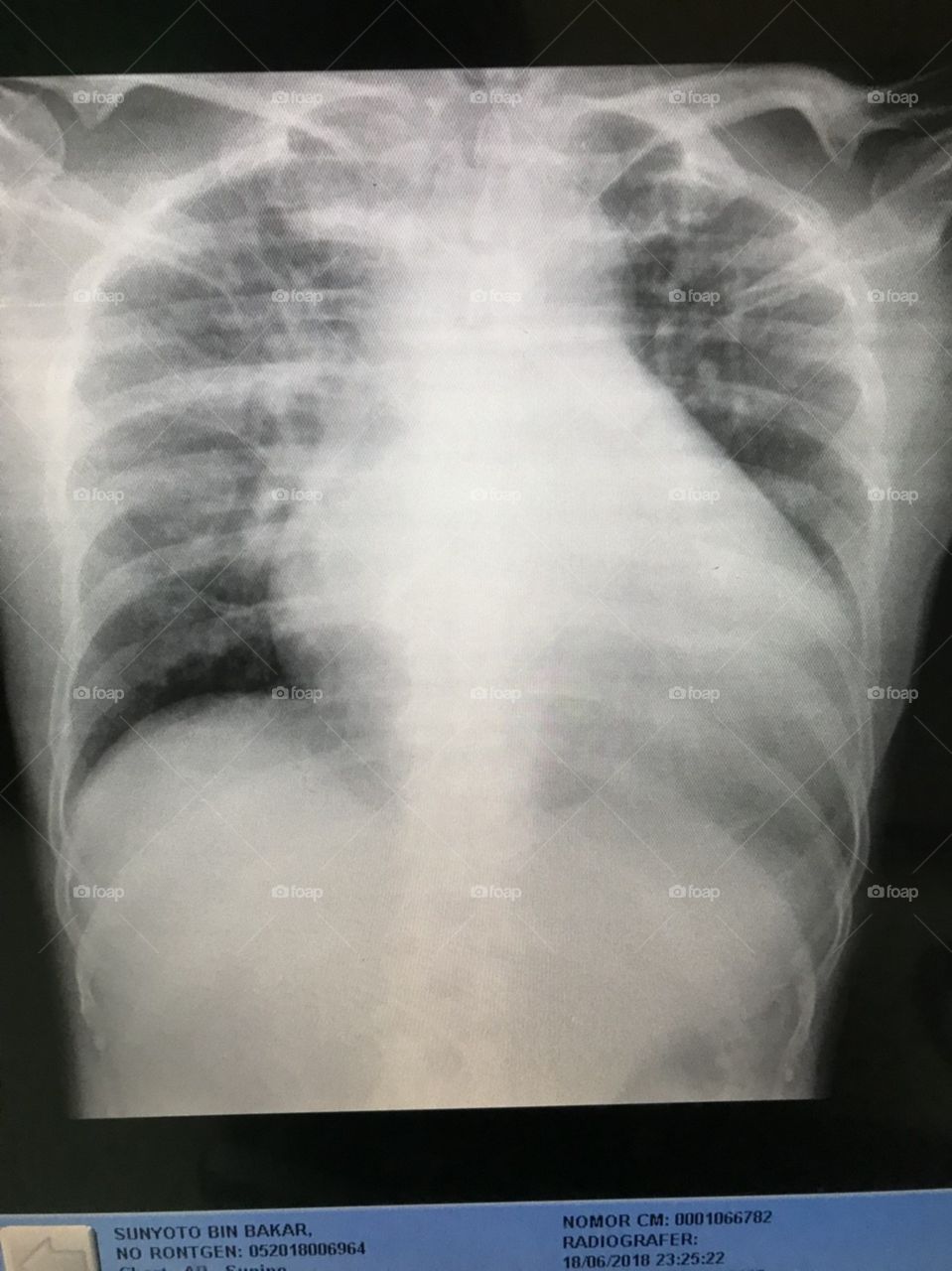 x ray patology