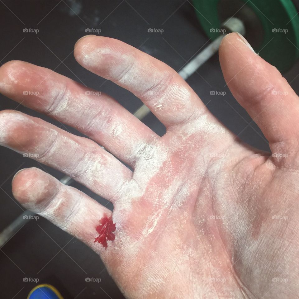 Bleeding hand from ripping calluses doing CrossFit.
