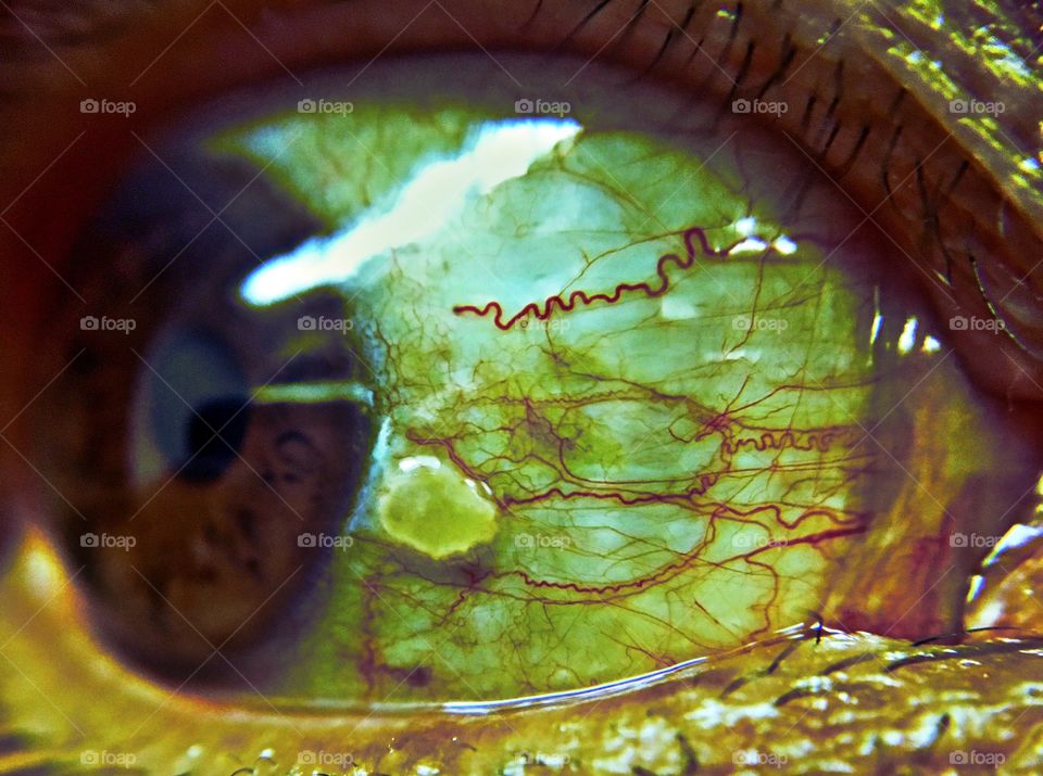 Eyeball under macro lens. 