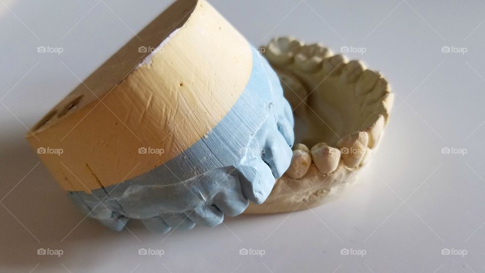 Dental impressions