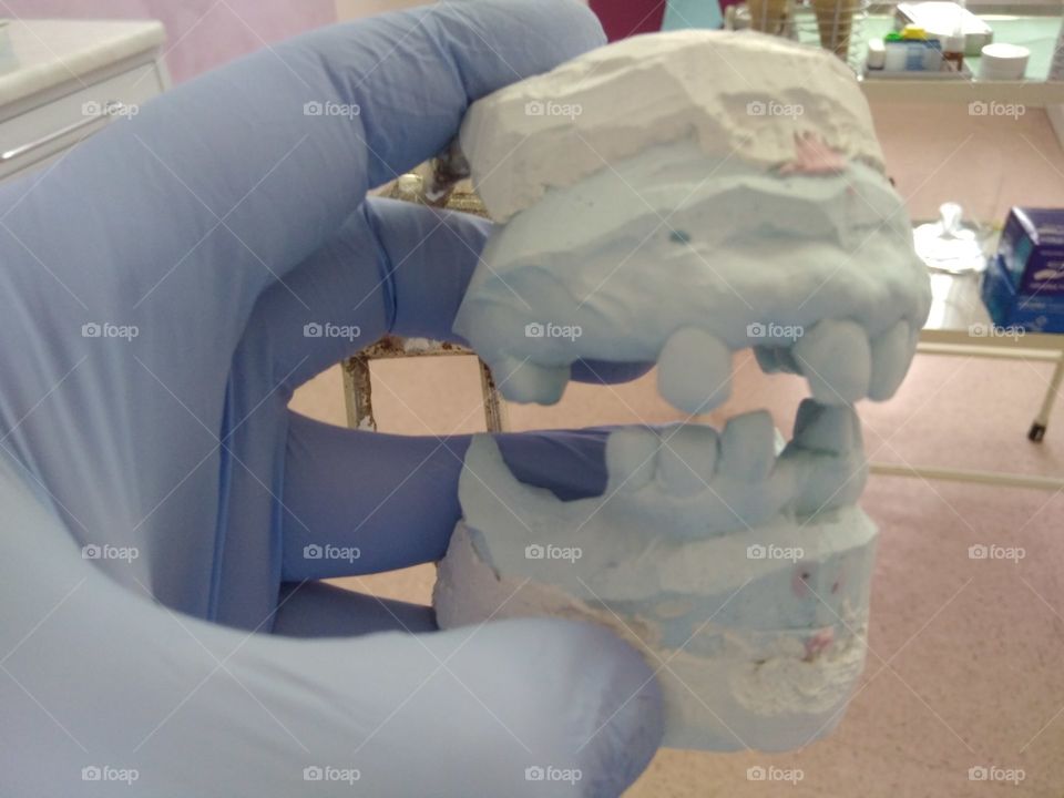 Dental model