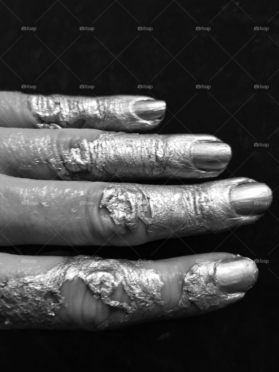 Silver hand