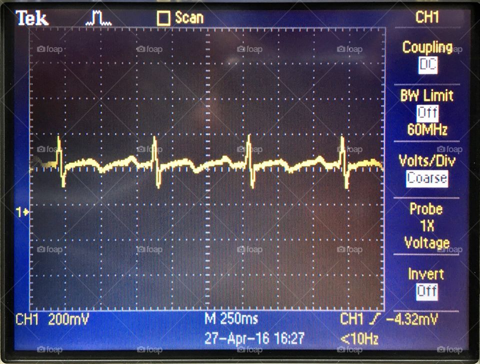 Graph, Growth, Chart, Shares, Forecast