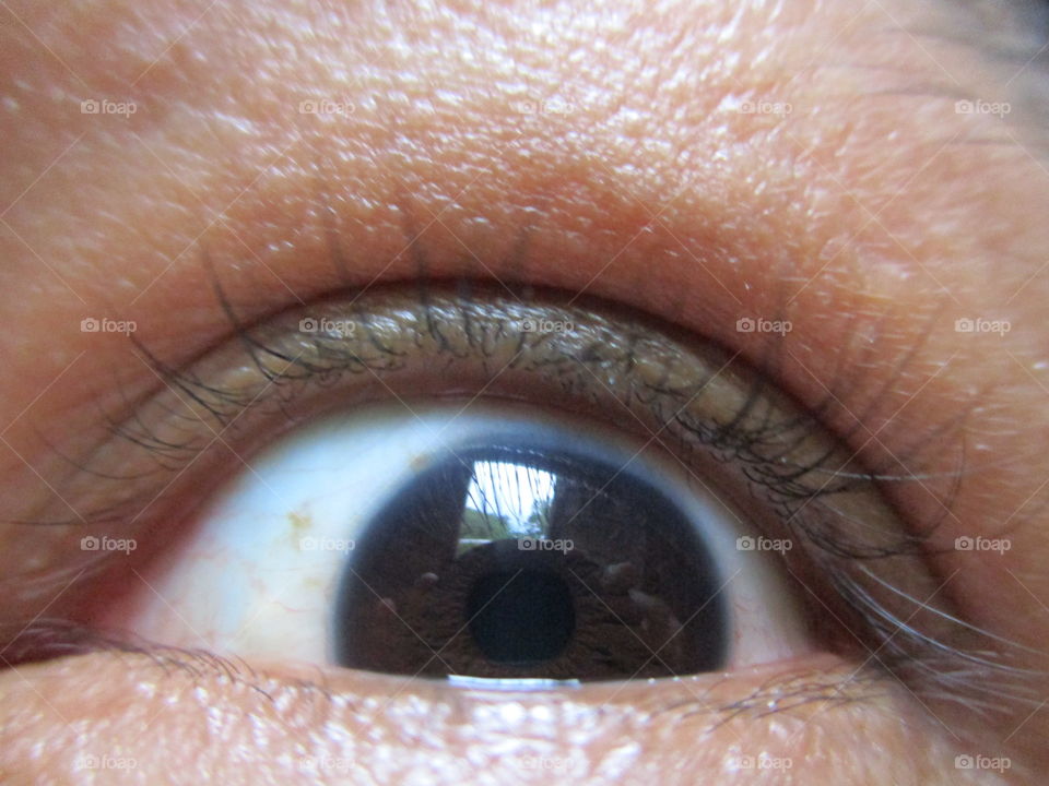 eye